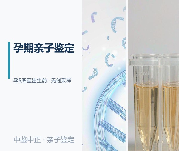 杭州孕期亲子鉴定需要怎么做,杭州孕期亲子鉴定机构电话是多少